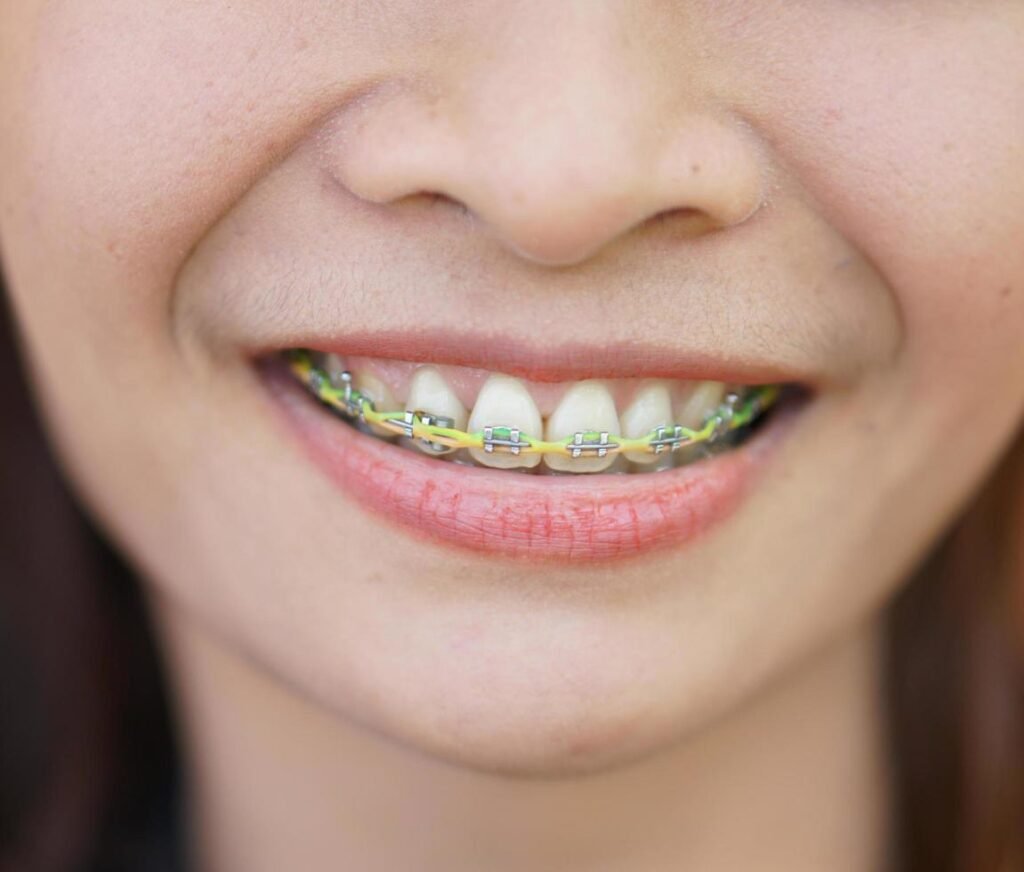 yellow braces in woman s mouth free photo
