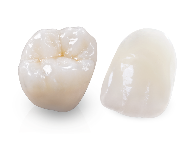 porcelain veneer