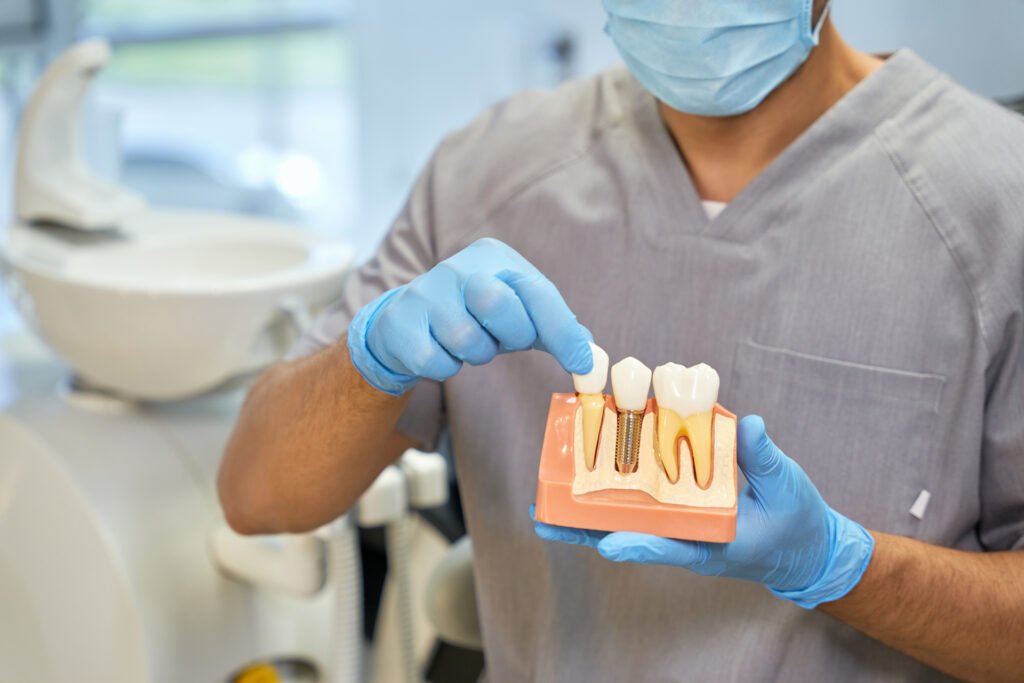 dental implant dentist